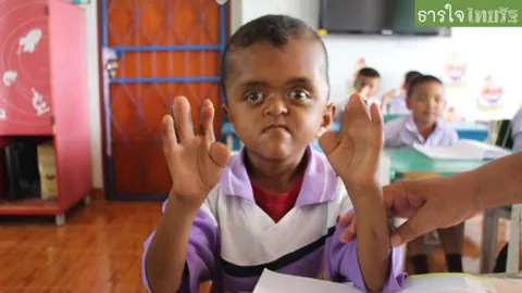 น้ำใจคนไทย! แห่ช่วย'อิคคิว' เด็กพิการซ้ำซ้อน ยากจน ไร้นิ้วมือ-นิ้วเท้า