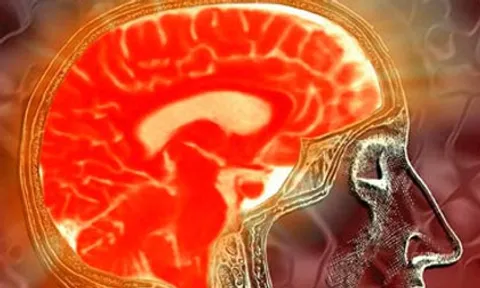 หัวโตเป็นของดี ป้องกันพิษภัย ของโรคสมองเสื่อมไว้ได้