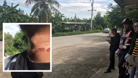 ปริศนาสายไฟขึงกลางซอยคลองห้า บาดคอนักศึกษา หวั่นโจรปล้น เตือนคนระวัง