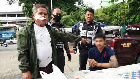 ทำคุณบูชาโทษ! หนุ่มเมาขอน้ำดื่ม รปภ.หาให้กลับถูกกัดปากฉีก เย็บ 9 เข็ม