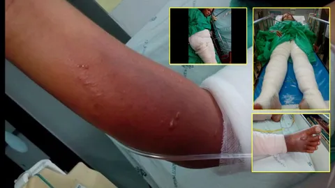แม่ค้าก๋วยเตี๋ยวราดน้ำร้อนคนขายชาไข่มุก ยันไม่ได้สาดแต่โยนใส่ทั้งหม้อ 