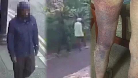 โหดเหี้ยมเกิน! คลิปโจรป่วยจิต ปล้นกลางวันแสกๆ ทำคนแก่วัย 92 เจ็บหนักทั้งตัว  