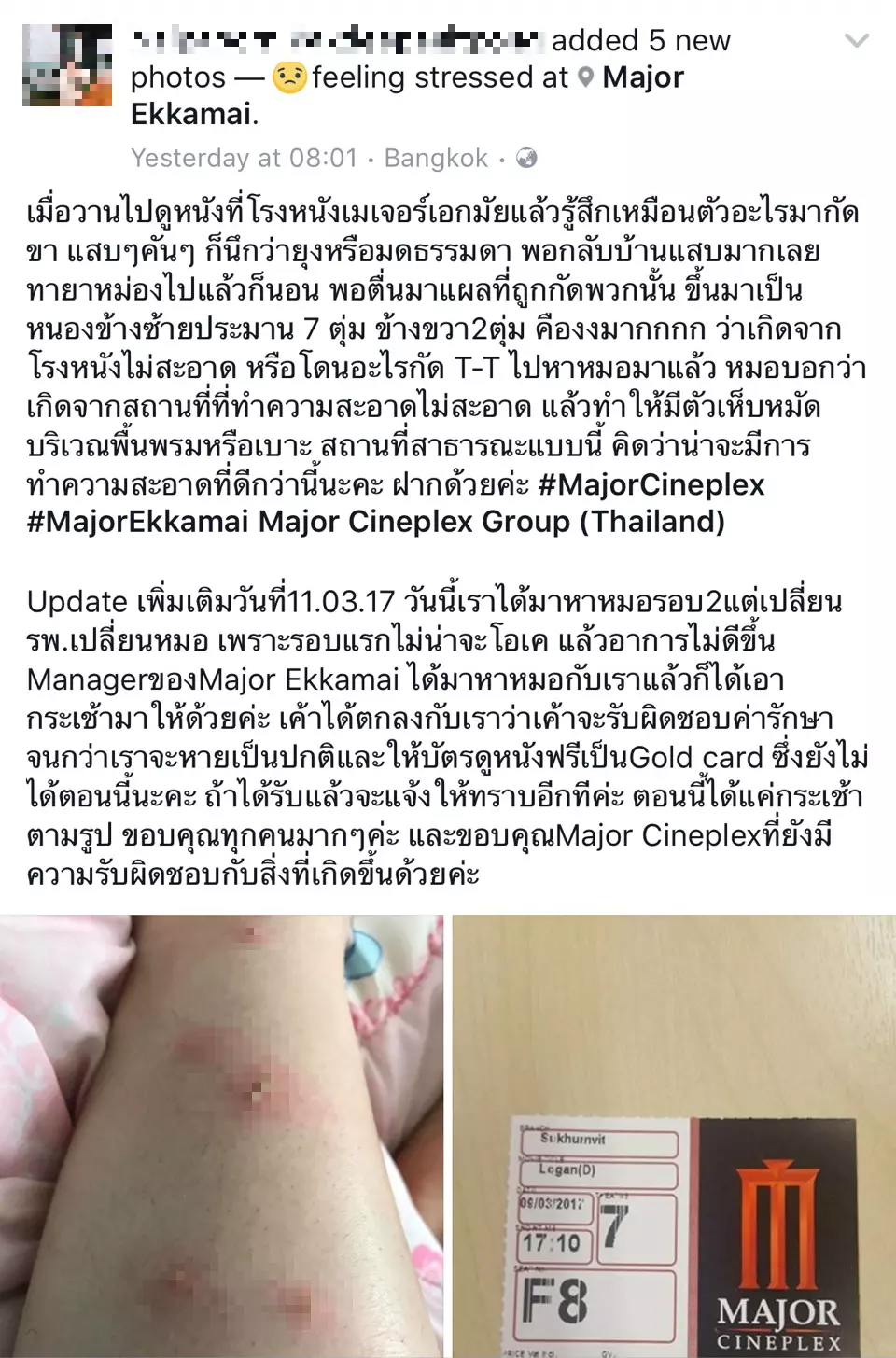 เมเจอร์แจงดราม่า ลูกค้ามีตุ่มหนองขึ้นขา ไม่ใช่เห็บหมัดกัดในโรงหนัง