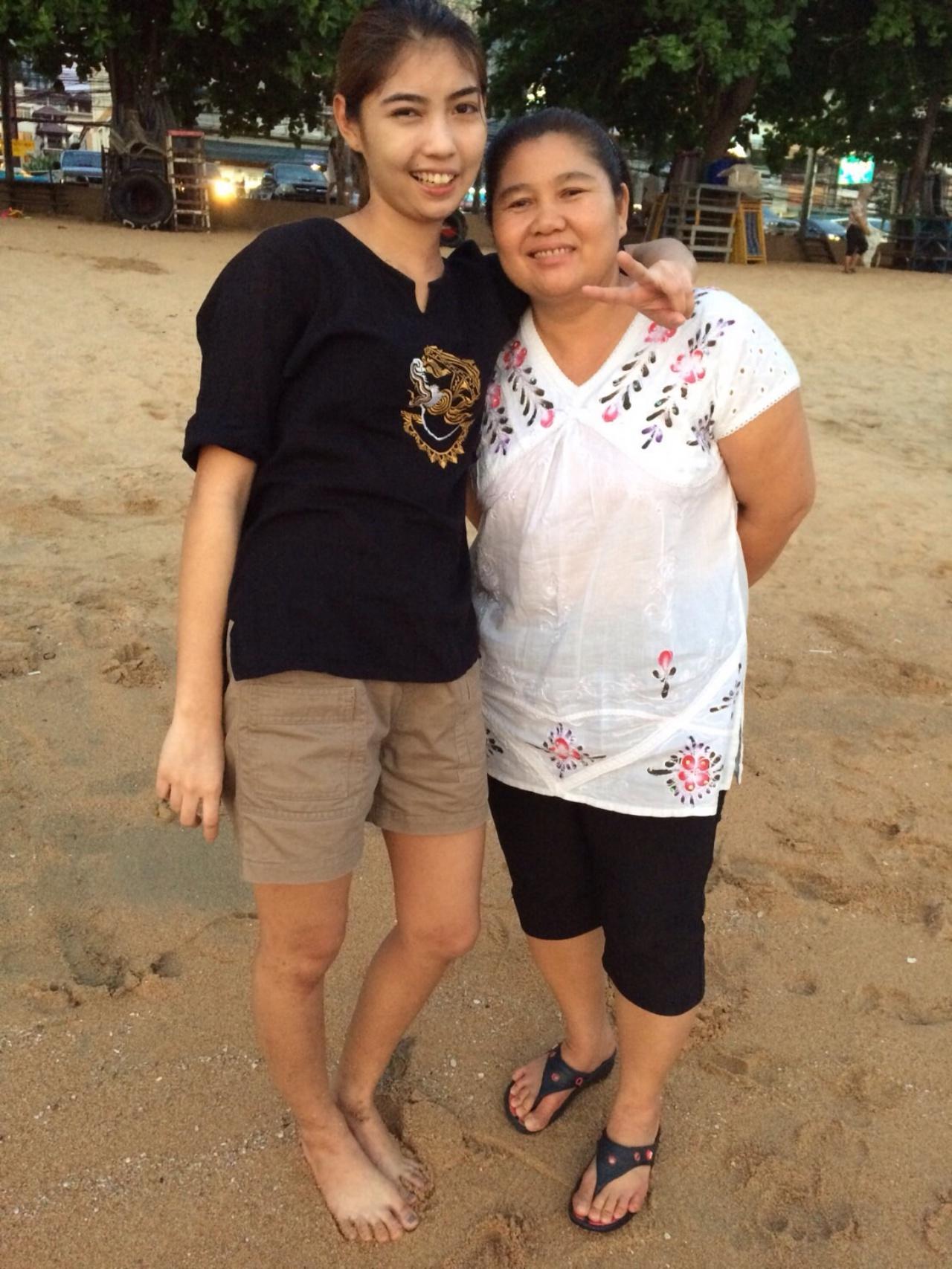 น้องทรายกลับมาใช้ชีวิตได้ปกติ ไม่ต้องหลบผู้คน เพราะอายที่ปากเบี้ยวอีกต่อไปแล้ว (กับคุณแม่ที่พัทยา จ.ชลบุรี เมื่อ 13 มี.ค. 60)
