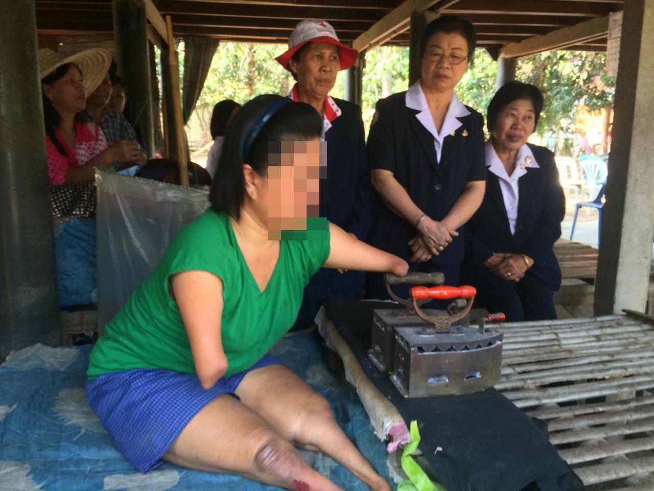 ยอดกตัญญู สาวพิการ สู้ชีวิต! แขน-ขาด้วน รีดใบตองขาย เพื่อดูแลพ่อชรา