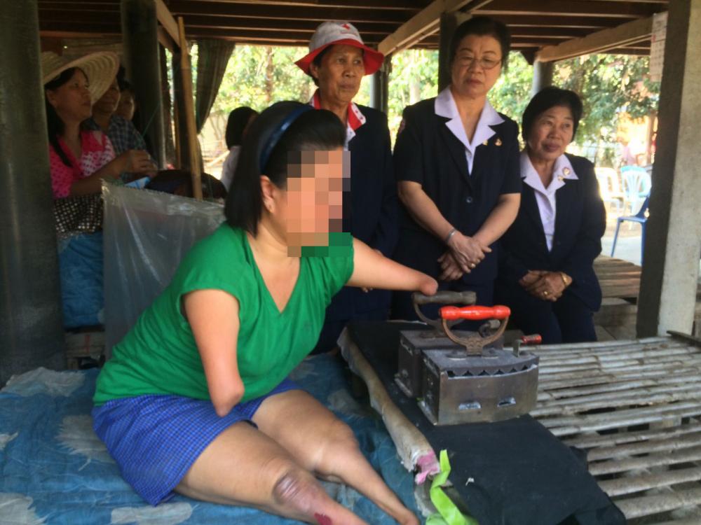 ยอดกตัญญู สาวพิการ สู้ชีวิต! แขน-ขาด้วน รีดใบตองขาย เพื่อดูแลพ่อชรา