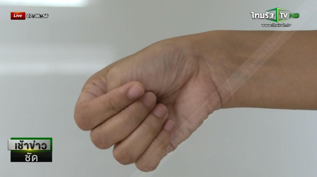 กำนิ้วหัวแม่มือ แล้วบิดข้อมือไปด้านนิ้วก้อยหากเจ็บก็มีความเสี่ยง