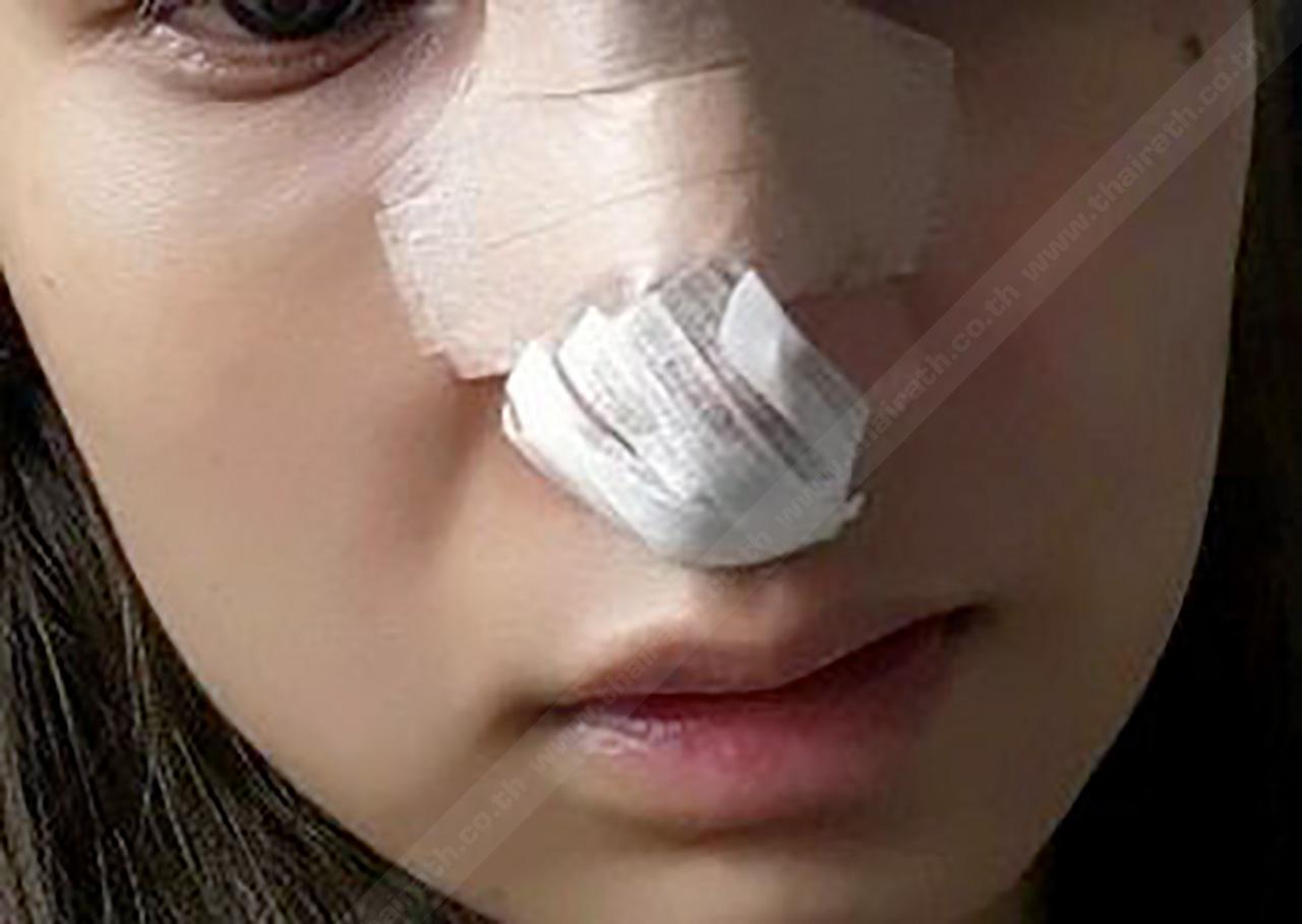 ศัลยกรรมยอดฮิตของบรรดาหนุ่มสาวยุคใหม่