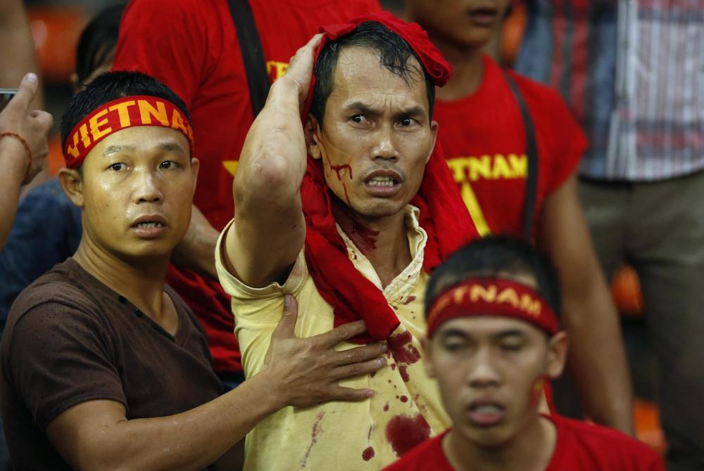 มีแฟนบอลที่ได้รับบาดเจ็บแต่ไม่พบรายงานผู้เสียชีวิต