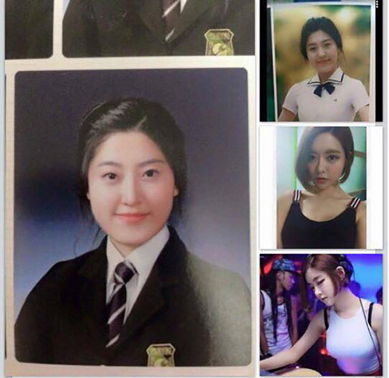 ดีเจโซดาก่อนศัลยกรรม