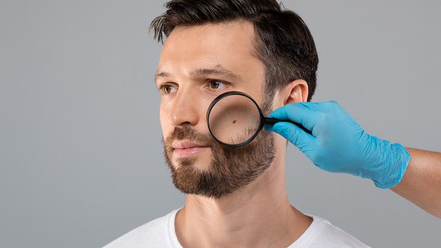 .ตำแหน่งไฝแต่ละที่บนใบหน้า ร้าย-ดี ควรมีหรือเอาออก?.