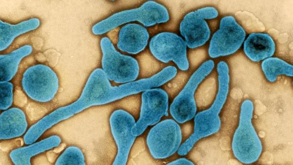 เชื้อไวรัสมาร์เบิร์ก