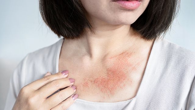 วงจรคันคะเยอ เอาแต่เกา เกาดีมั้ย? (ตอน 2)