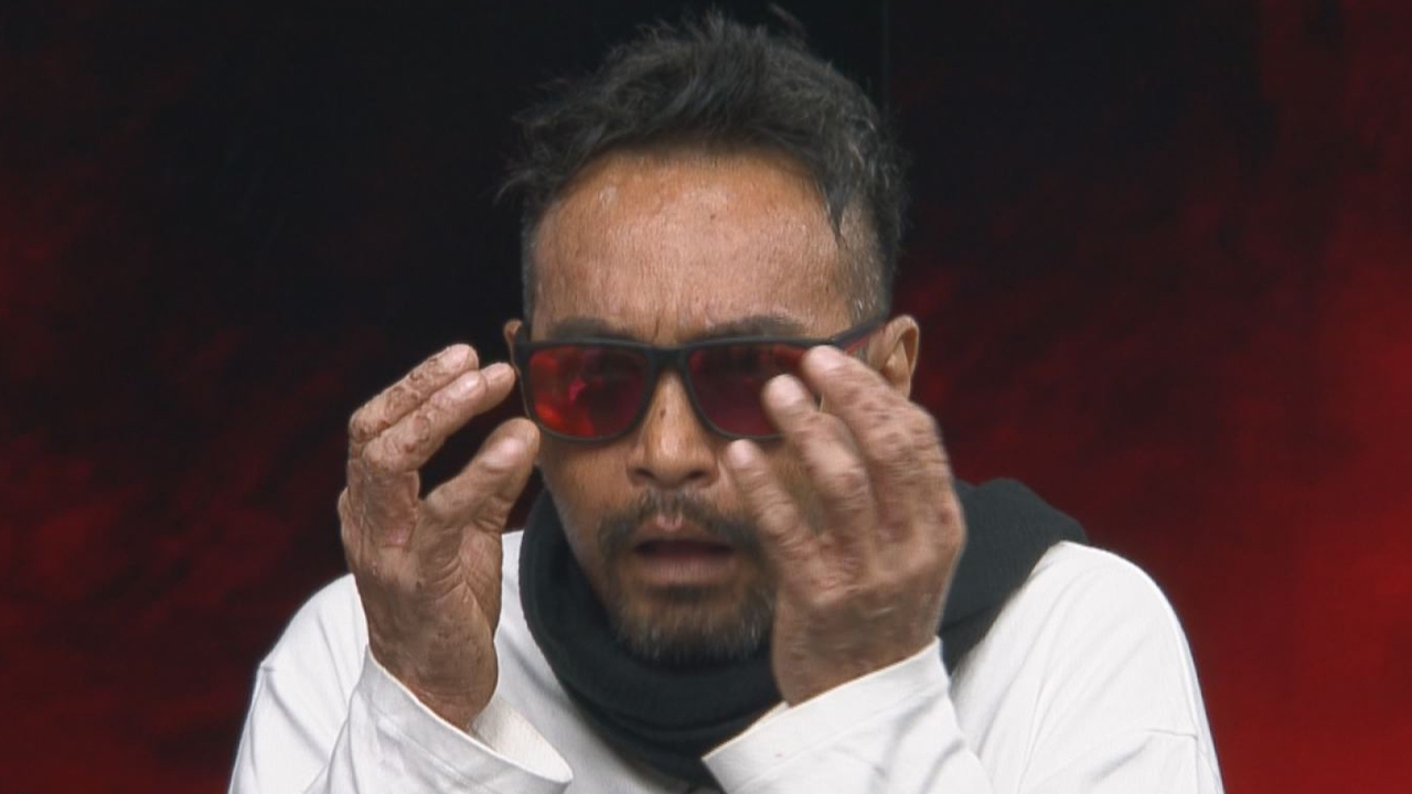 เมฆ วินัย รับสภาพตัวเองไม่ไหว เน่าทั้งตัว เอาเข็มทิ่ม-กรีดน้ำเหลืองไหล