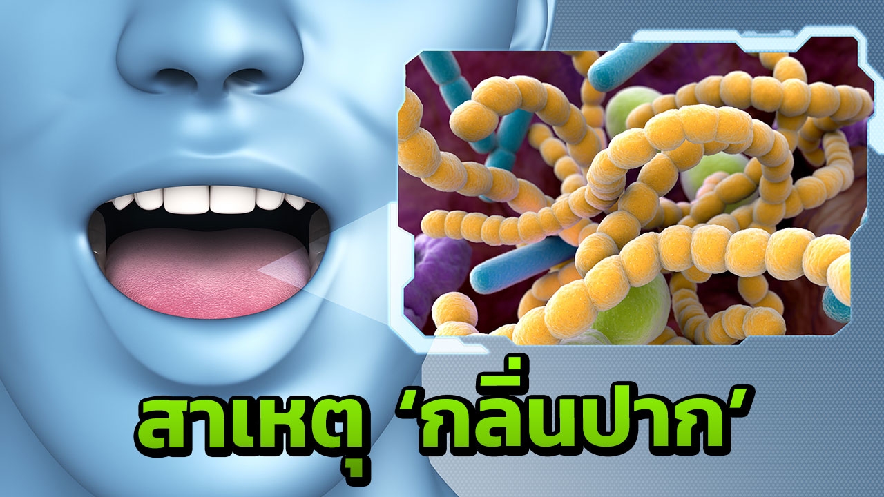 สาเหตุ "ปากเหม็น" ฟังชัดๆ "กลิ่นปาก" มาจากไหน?