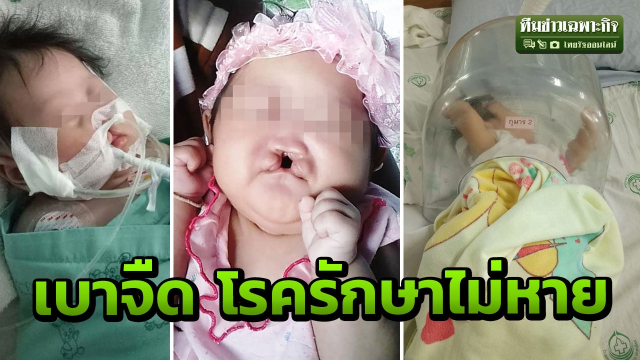 หัวใจไม่ใช่ภาระ! ลูก4เดือน ป่วยเบาจืด โรคหายาก หมดทางรักษา กินยาตลอดชีวิต (คลิป)