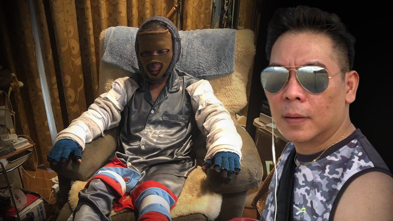 ผี ไฮแจ็ค เผยชีวิตที่เปลี่ยนไปเมื่อป่วย สิ่งที่เรียนรู้ ความหวังที่จะหาย