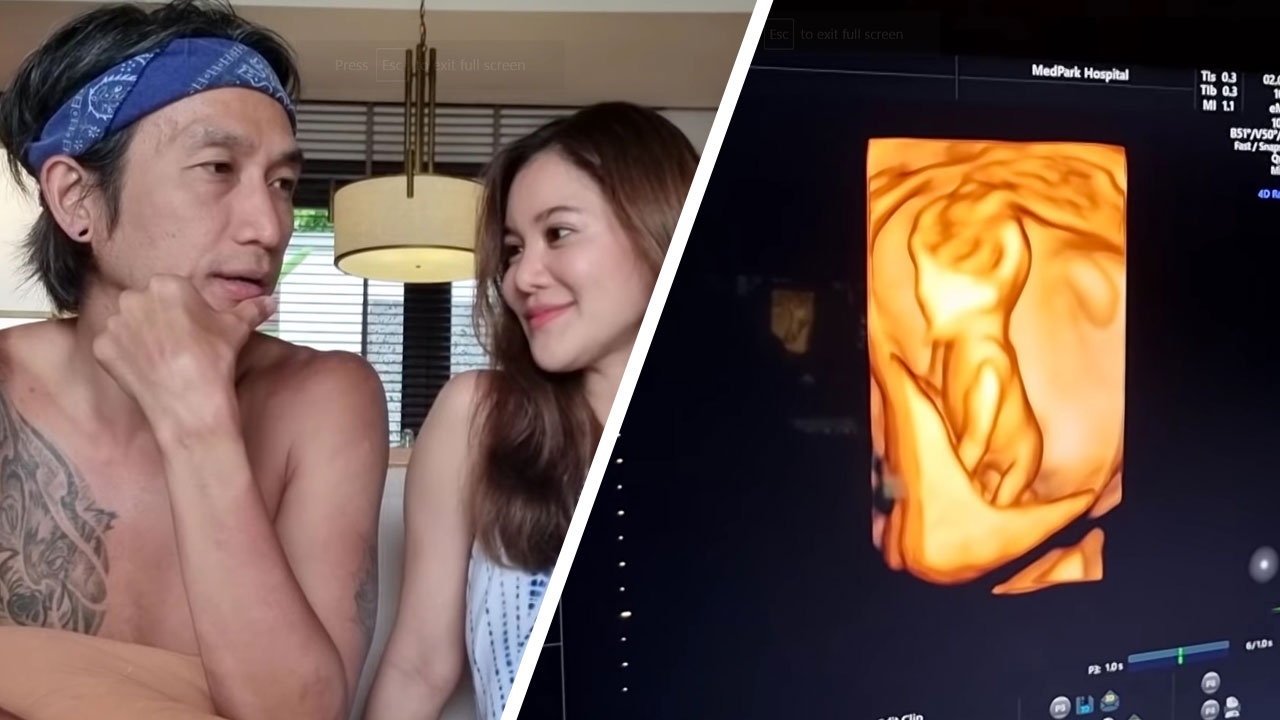 ก้อย-ตูน อัลตราซาวนด์ลูกคนแรก ทายเพศลูกด้วยเงินขวัญถุง 1 ล้าน (คลิป)