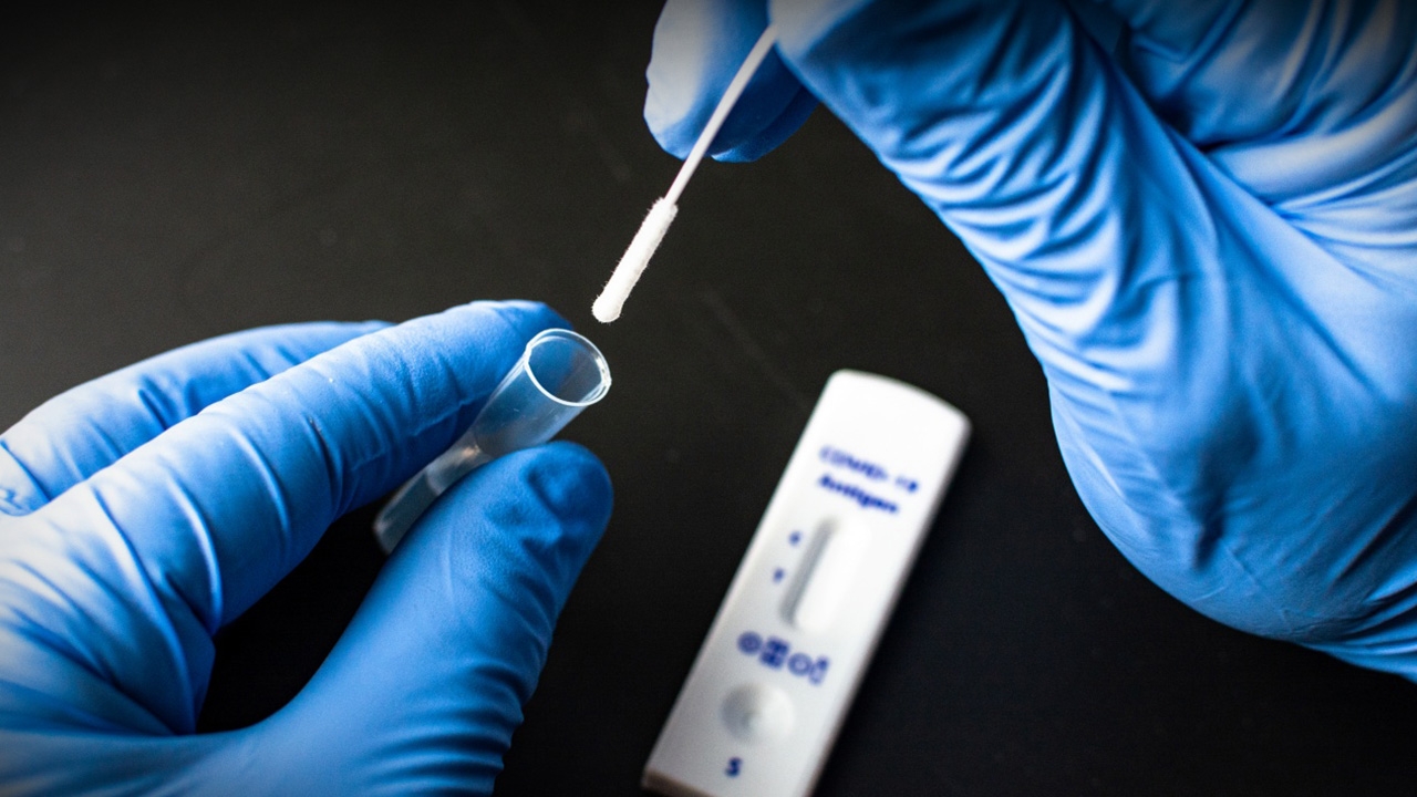 "Rapid Antigen Test" ทางเลือก คัดกรองโควิด ช่วงแพร่กระจาย ใช้ง่าย รู้ผลเร็ว