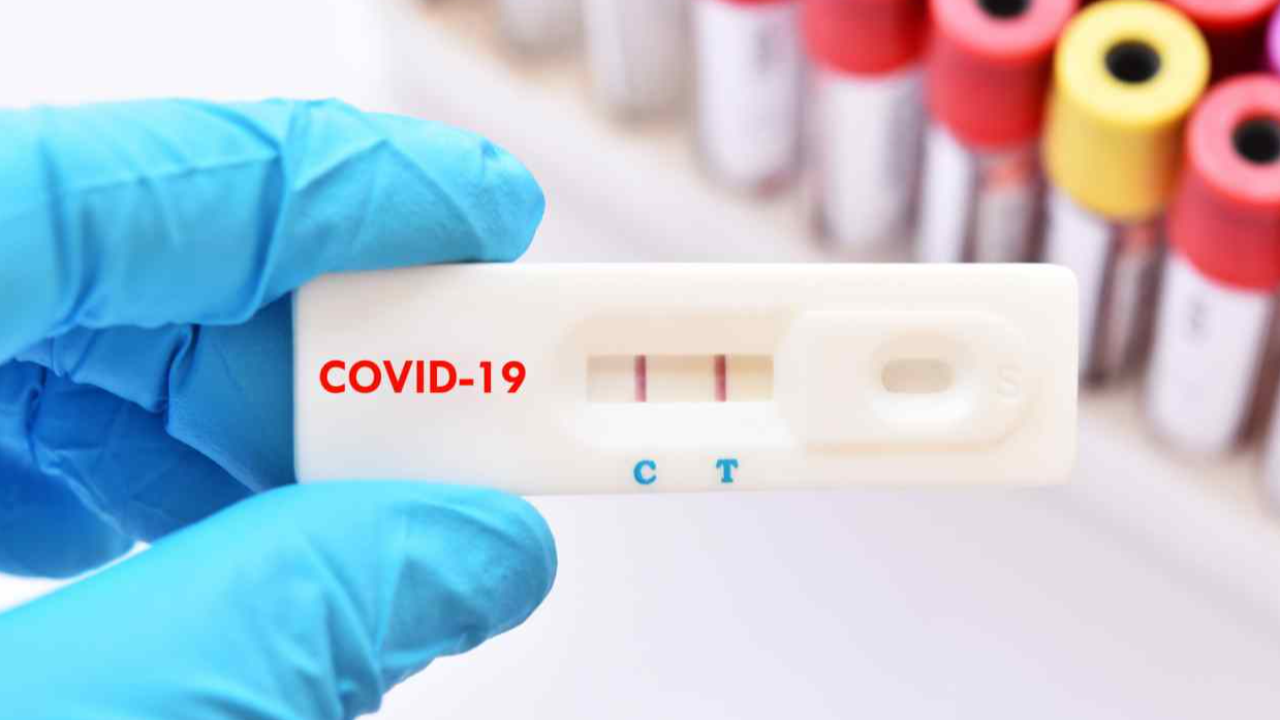 รู้จัก “ชุดตรวจโควิด Rapid Antigen Test” รู้ผล COVID-19 ใน 20 นาที