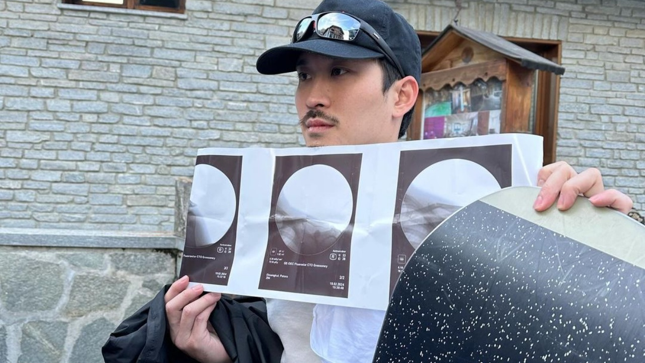 พระเอกหนุ่มฮอตหวิดสิ้นชื่อ ประสบอุบัติเหตุขณะเล่นสกีที่ต่างประเทศ 