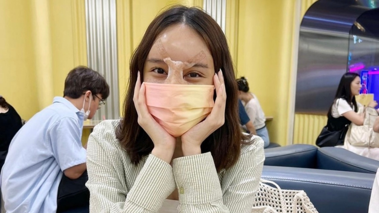 มิ้ง โป๊ะแตก บินทำศัลยกรรมเกาหลีหมดครึ่งล้าน ดักคอชาวเน็ตอย่าไร้มารยาท