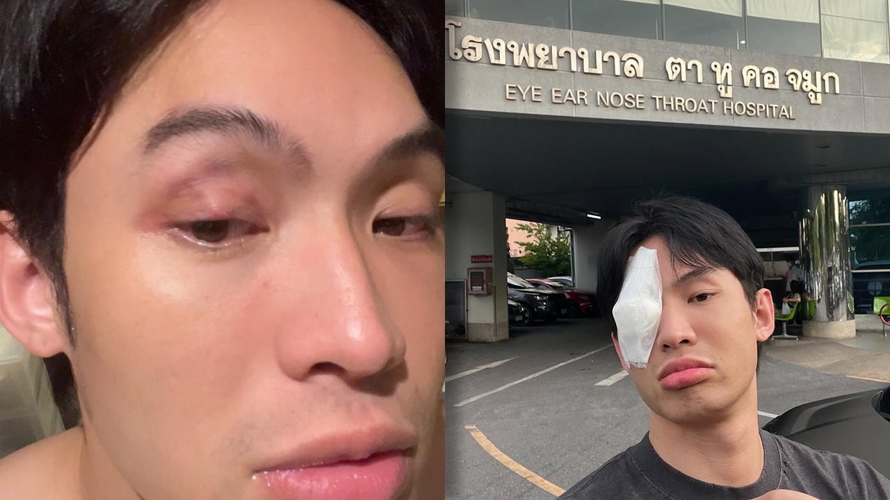 ดีเจมะตูม เล่าบทเรียนราคาแพง แค่คันตา แต่ไม่ยอมไปหาหมอสุดท้ายเป็นหนักกว่าเดิม!!