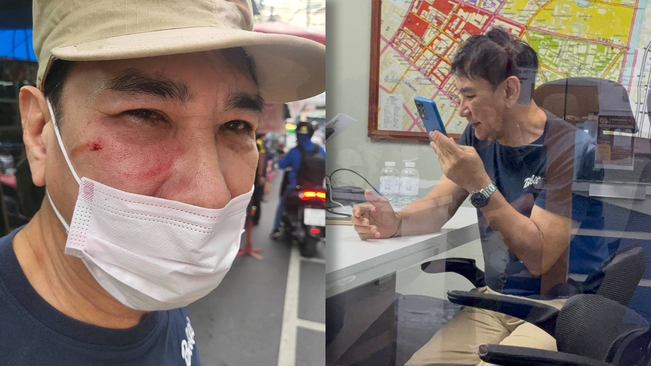 เปิดสาเหตุ "ทูน หิรัญทรัพย์" ถูกขาใหญ่ย่านคลองถมทำร้ายร่างกาย 