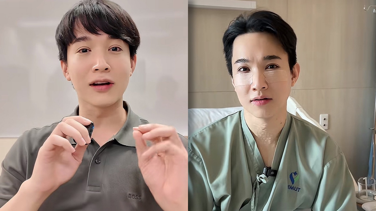 "หมอริท" งงใจชาวเน็ต เข้ามาแซะหน้าบวมหลังผ่าตัดถุงใต้ตา ลั่นเพิ่งผ่าเสร็จจะให้เป๊ะเลยเหรอ