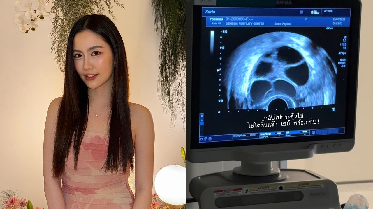 หมอฟรัง รีวิวฝากไข่ครั้งแรกในวัย 28 ปี พร้อมเผยเหตุผลที่ตัดสินใจทำ