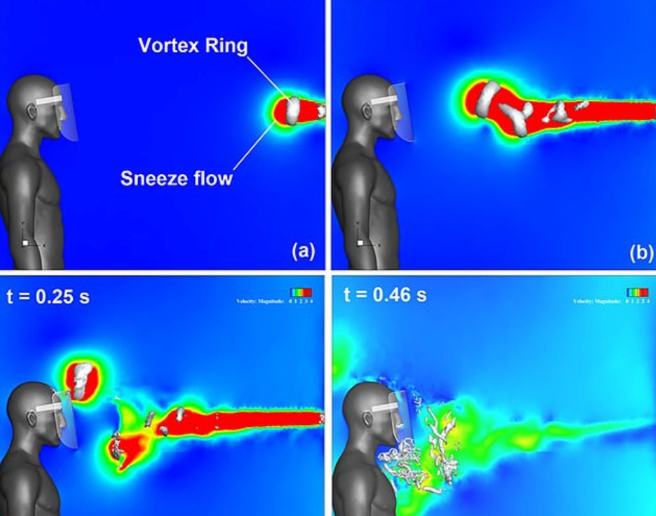 Cr ภาพจาก Fujio Akagi SWNS :  แสดงให้เห็นการเคลื่อนที่ของละอองฝอยที่มีเชื้อโควิด-19 ปะปนอยู่สามารถลอยผ่านเฟซชิลด์เข้าไปในบริเวณจมูกได้ หากผู้ติดเชื้อจามใส่ในระยะห่าง 3 ฟุต