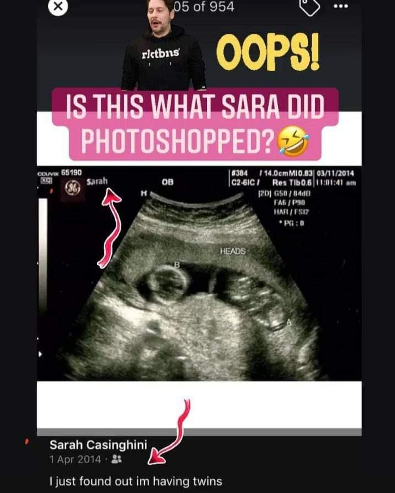 ภาพอัลตราซาวนด์จากเฟซบุ๊กซาร่า