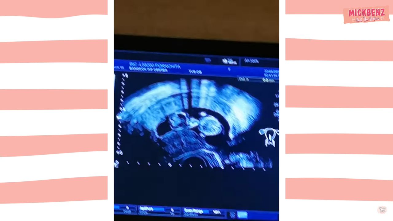 ขอบคุณภาพจากยูทูบแชนแนล MickBenzChannel