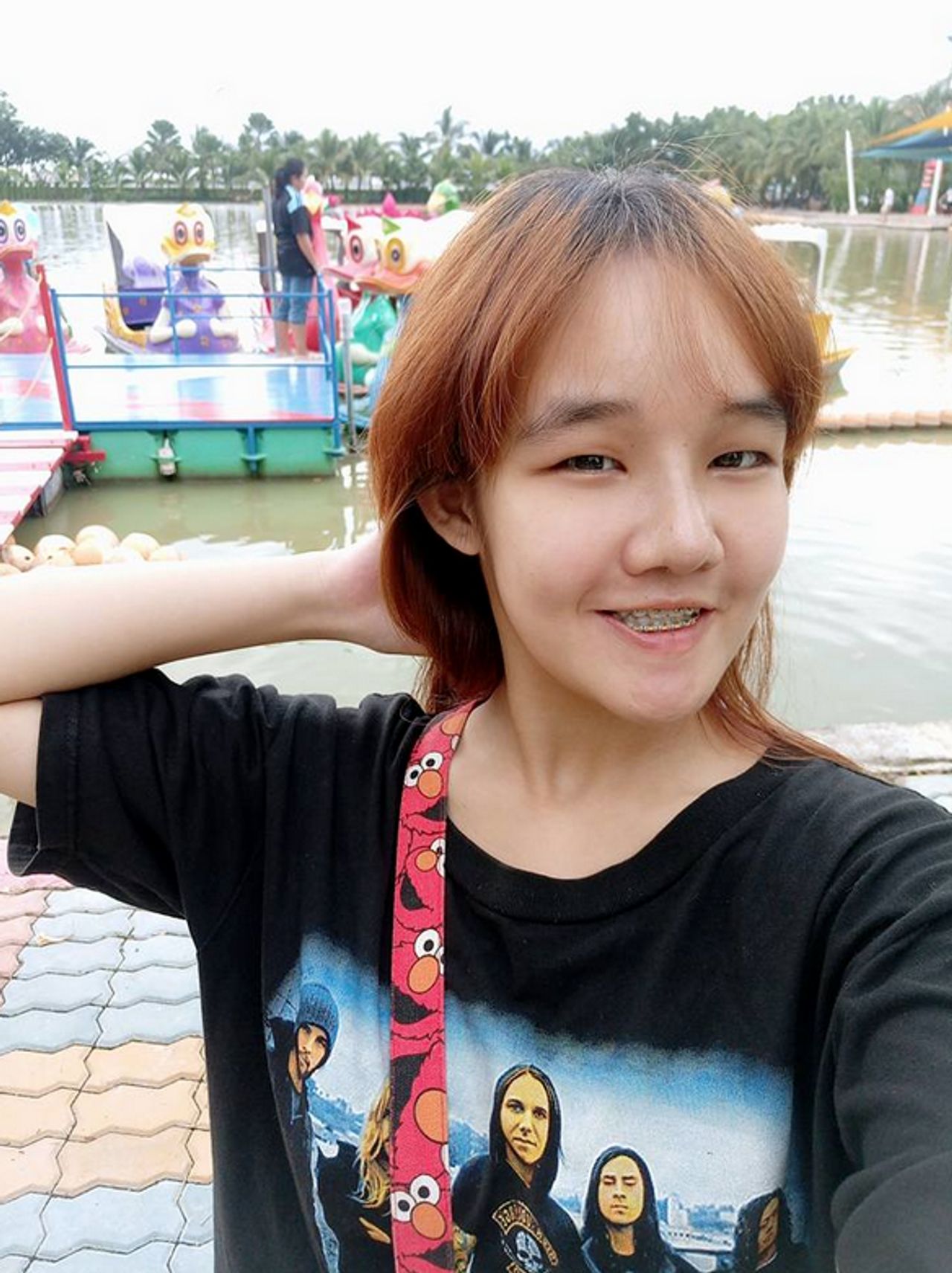 น้องคิตตี้หลังทำศัลยกรรม 