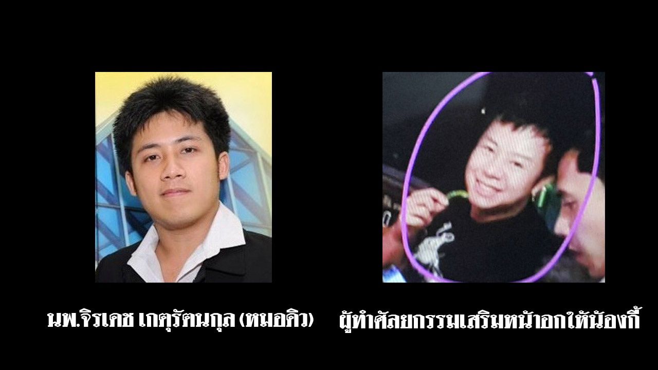 ภาพเปรียบเทียบใบหน้า