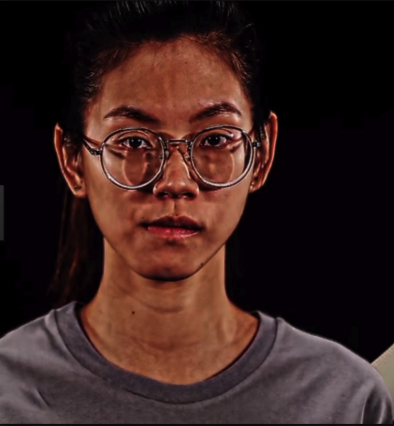 ก่อนศัลยกรรม