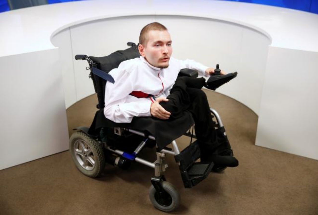 นายวาเลอรี สปิริโดนอฟ อาสาสมัครผ่าตัดเปลี่ยนหัว