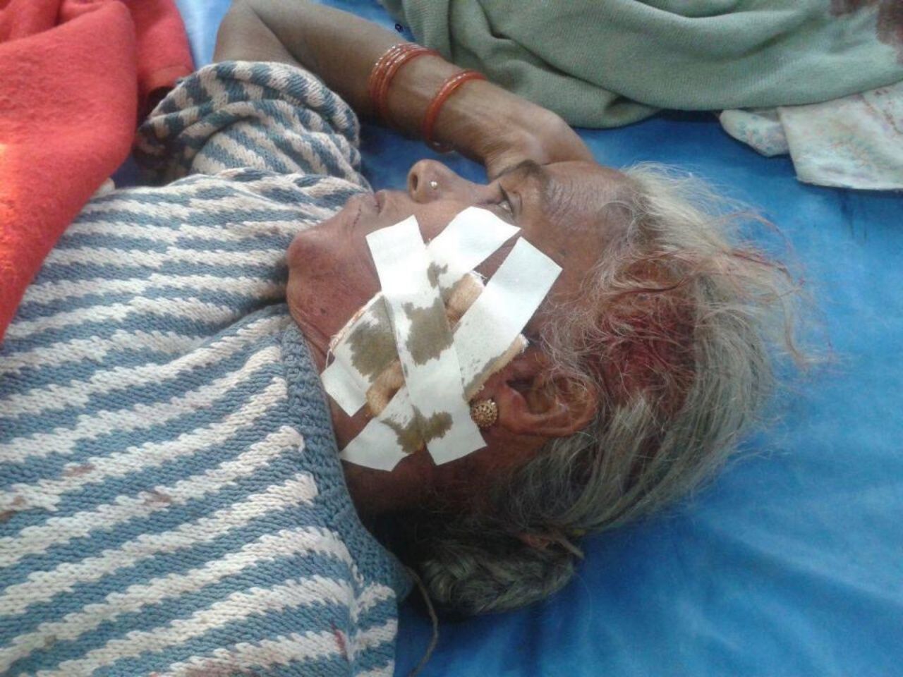 เสือทำร้ายหญิงคนหนึ่งได้รับบาดเจ็บ