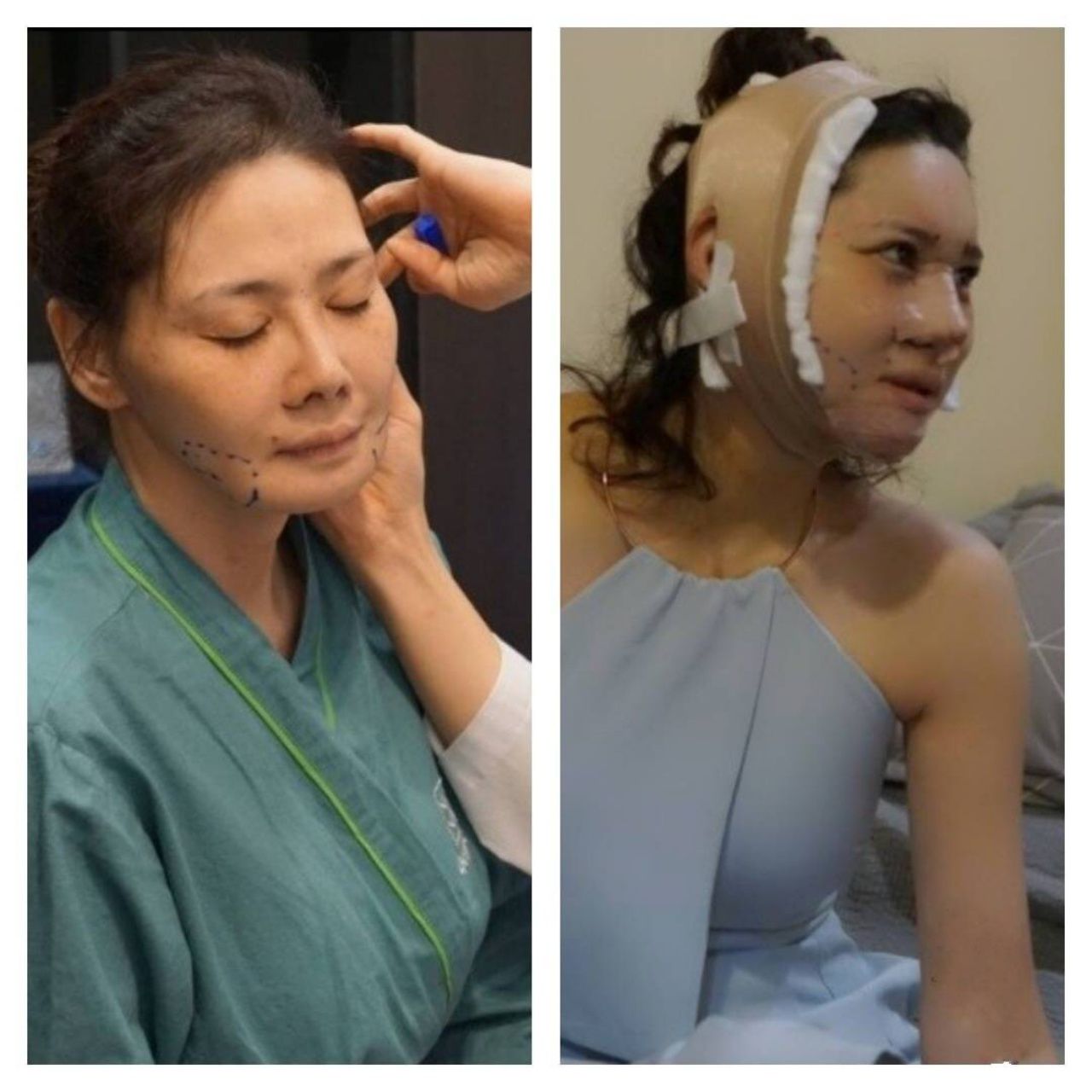 ก่อนทำ-หลังทำ