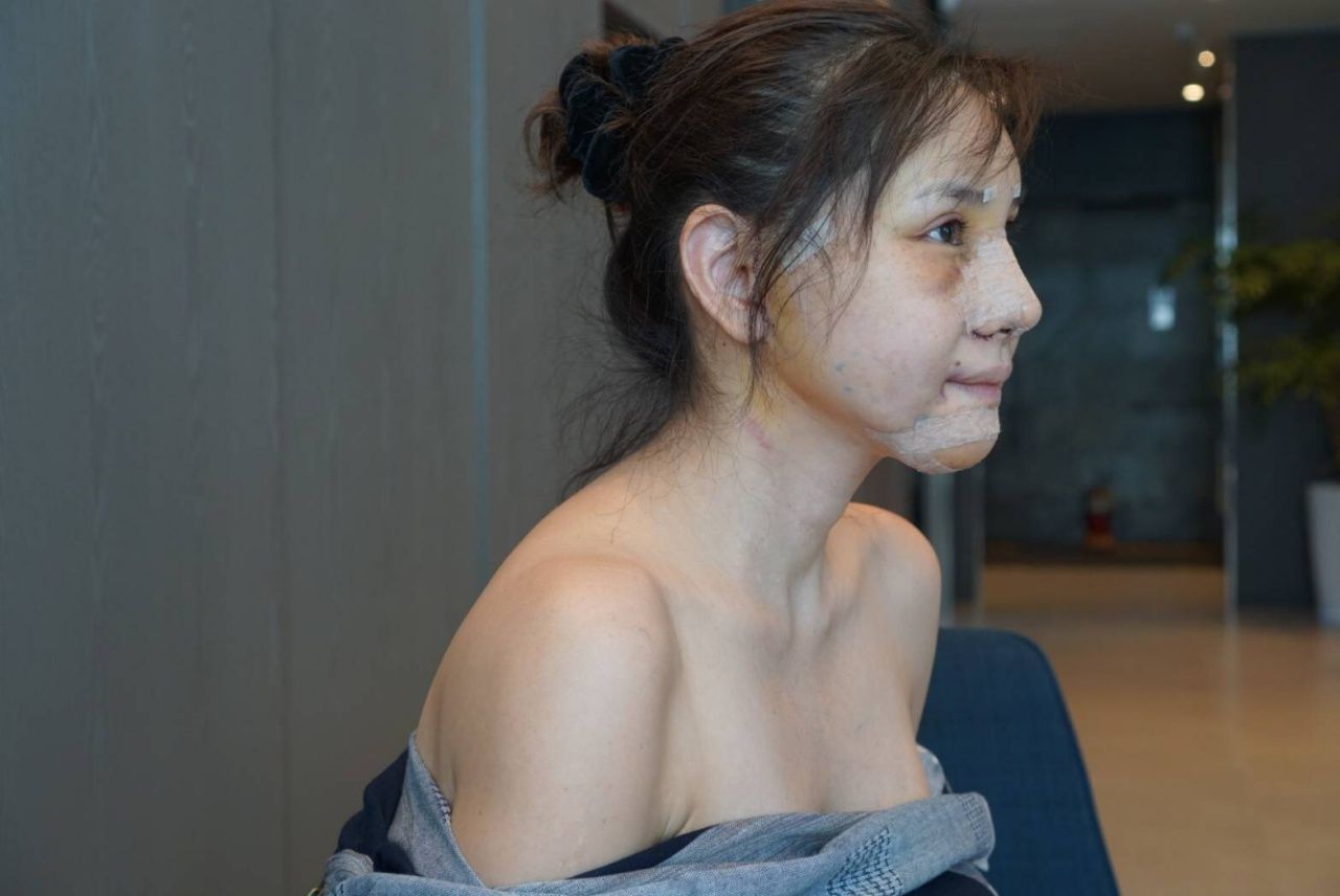 หลังทำแทบจำไม่ได้