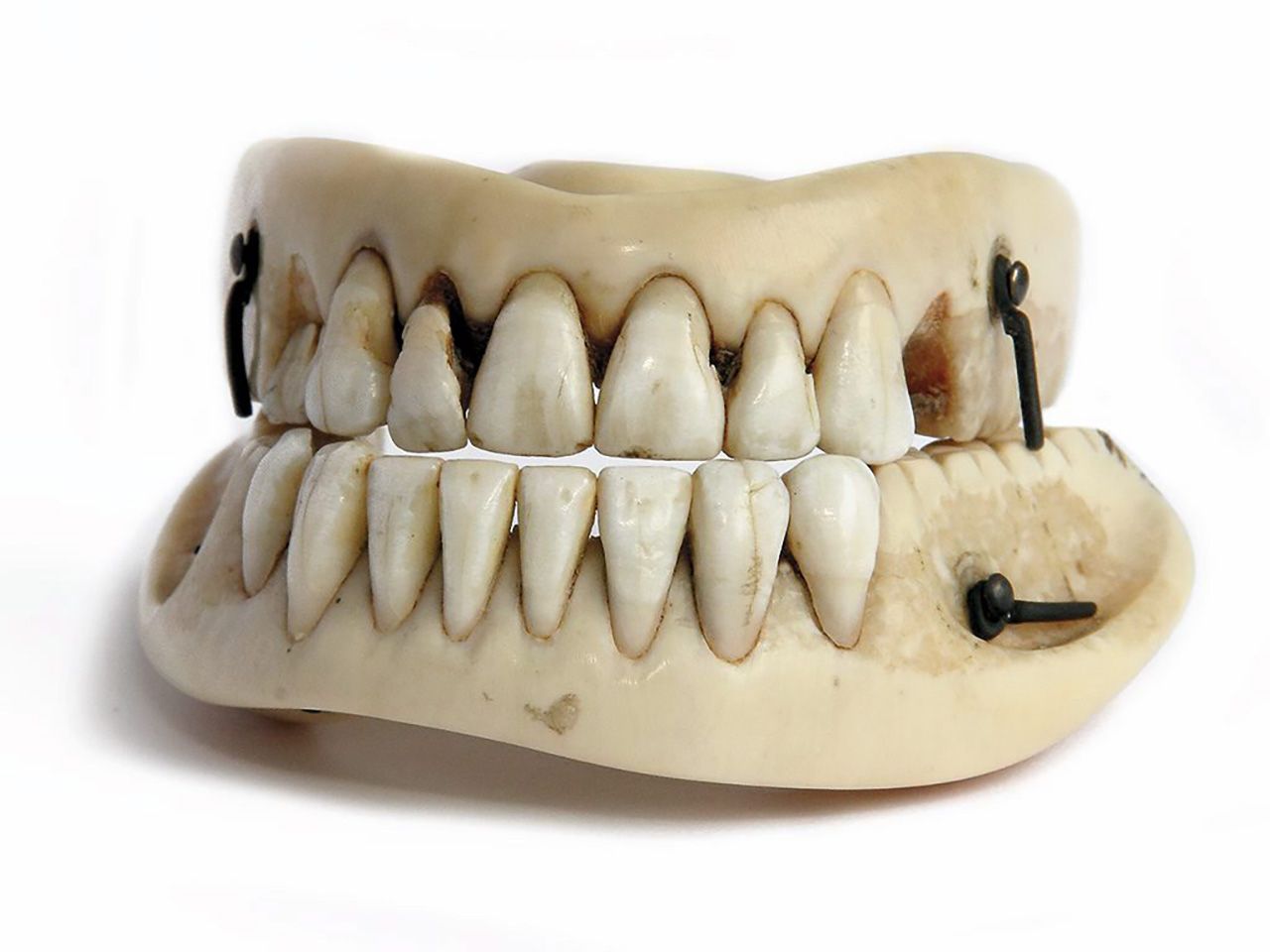 ฟันปลอมที่ทำจากฟันมนุษย์จริงๆ บนฐานที่ทำงาช้าง.