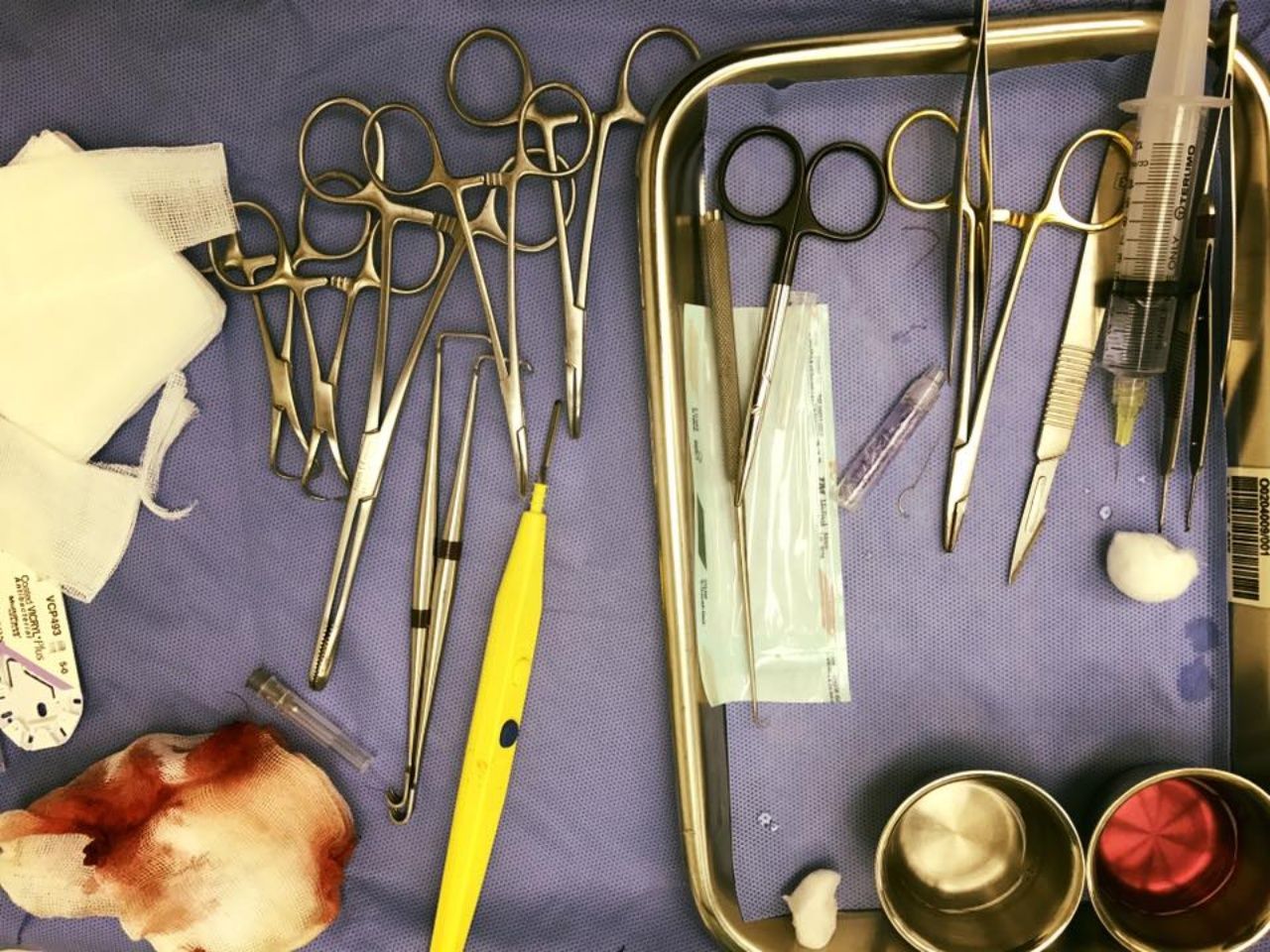 อุปกรณ์การแพทย์ในห้องผ่าตัด ขอบคุณภาพจากเพจ 