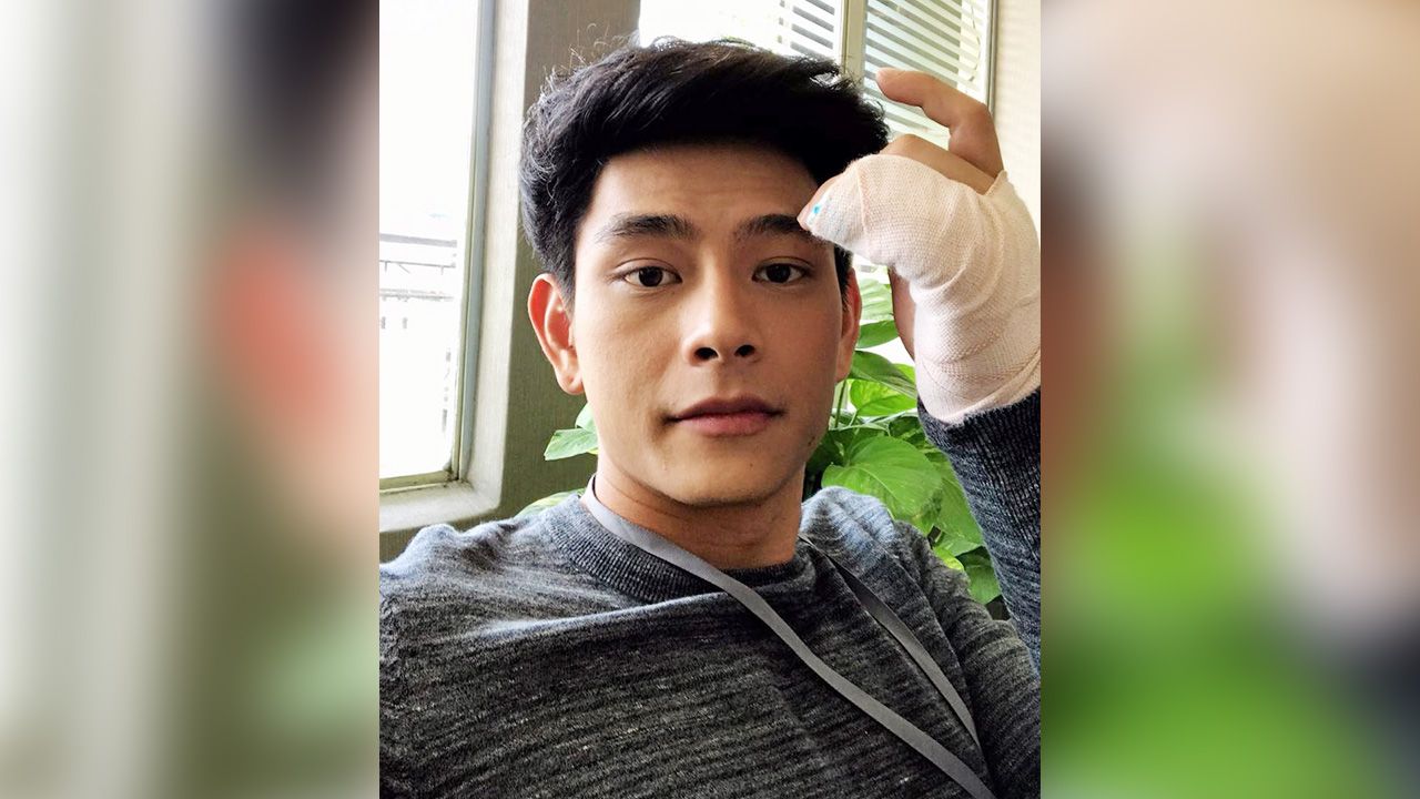 เหล่สาวเพลินไปนี้ดส์ เอี๊ยง-สิทธา สะดุดล้มนิ้วหักต้องเข้าเฝือก แต่ก็ยังกัดฟันมาถ่ายละคร “เทพธิดาขนนก” ช่อง 8 ถึงบู๊ออกหมัดได้ไม่เต็มที่ แต่ตีเข่า เขย่าศอกได้อยู่.