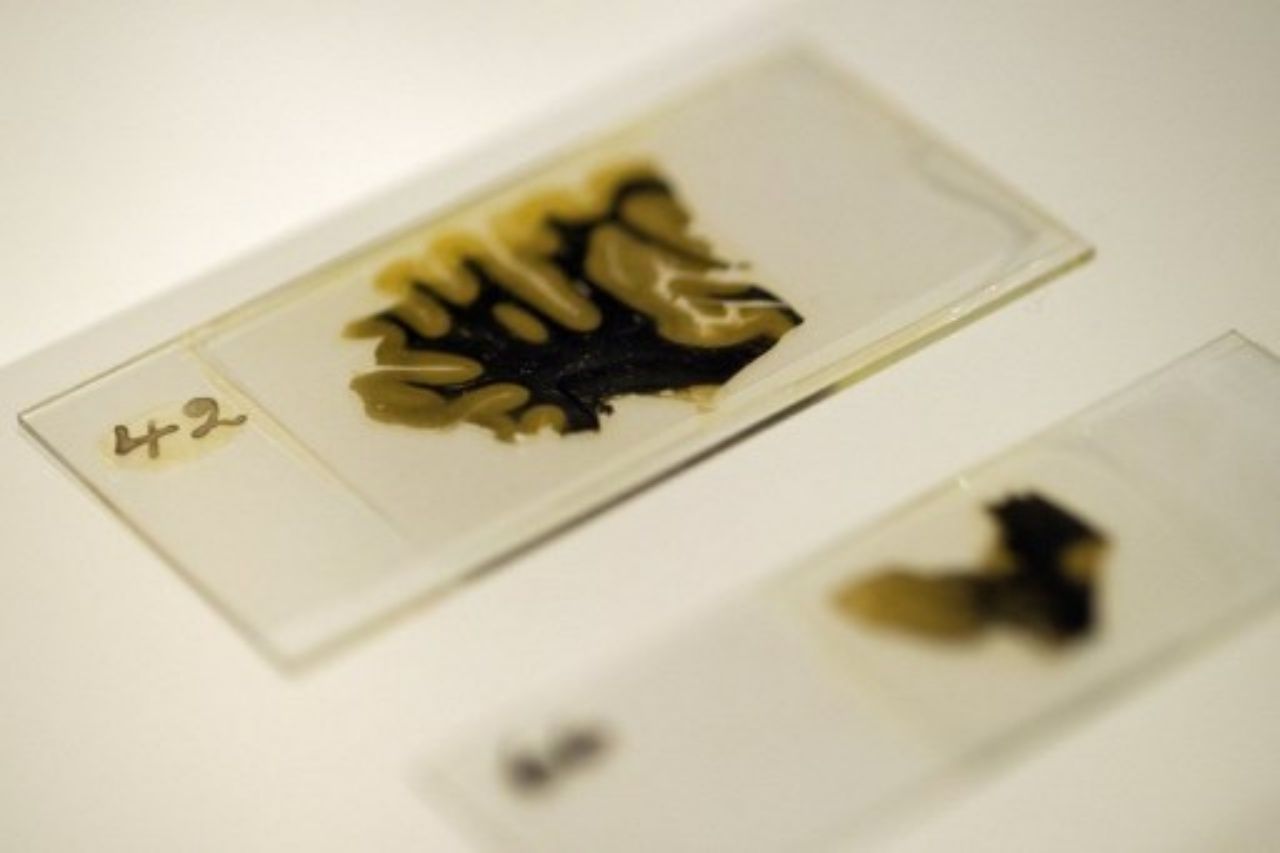 ตัวอย่างเนื้อเยื่อจากสมองของไอน์สไตน์