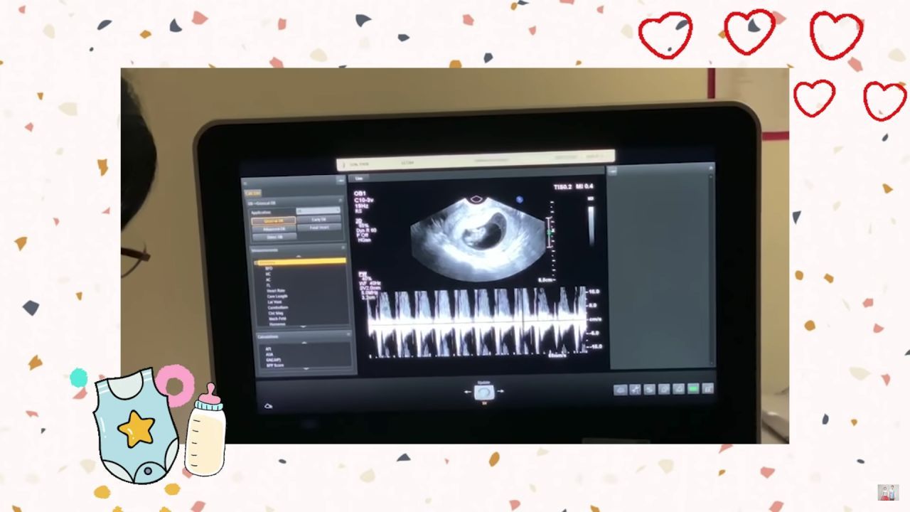 ขอบคุณภาพจากยูทูบ FatMango Channel