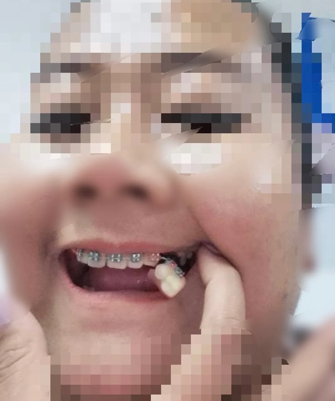 เหยื่อหมอจัดฟันเถื่อน