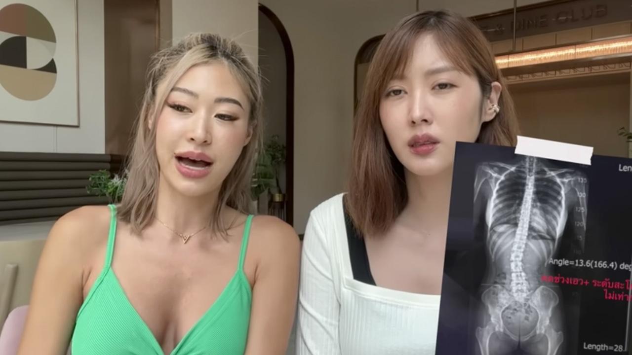 ยิปซี คีรติ เตือนใจคนอยากสวย โหมออกกำลังกายหนักระวังกระดูกสันหลังคด