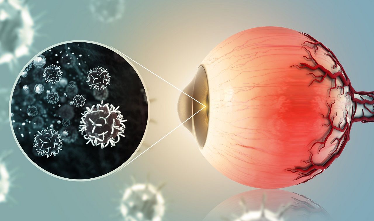 ข้อดีของการรักษามะเร็งตาด้วยการวางแร่คือเป็นการทำครั้งเดียว ผู้ป่วยไม่ต้องมาทำการรักษาซ้ำๆ ทำให้ต้องเสียค่ารักษาจำนวนมากเหมือนการรักษาด้วยวิธีอื่นๆ และยังไม่ส่งผลกระทบไปยังอวัยวะบริเวณอื่นที่ใกล้เคียงอีกด้วย 