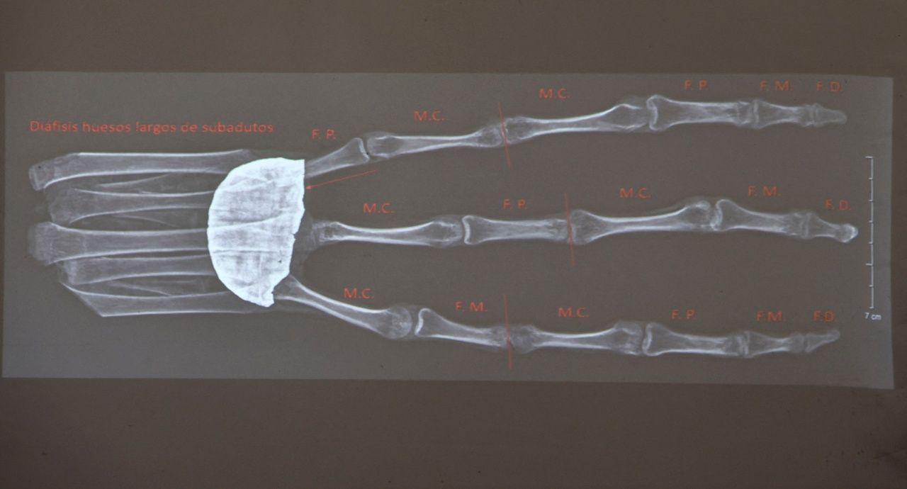 สถาบัน  Institute of Legal Medicineของเปรู เผยภาพ X-Ray วัตถุปริศนาคล้ายตุ๊กตา ยืนยันไม่ใช่เอเลี่ยน