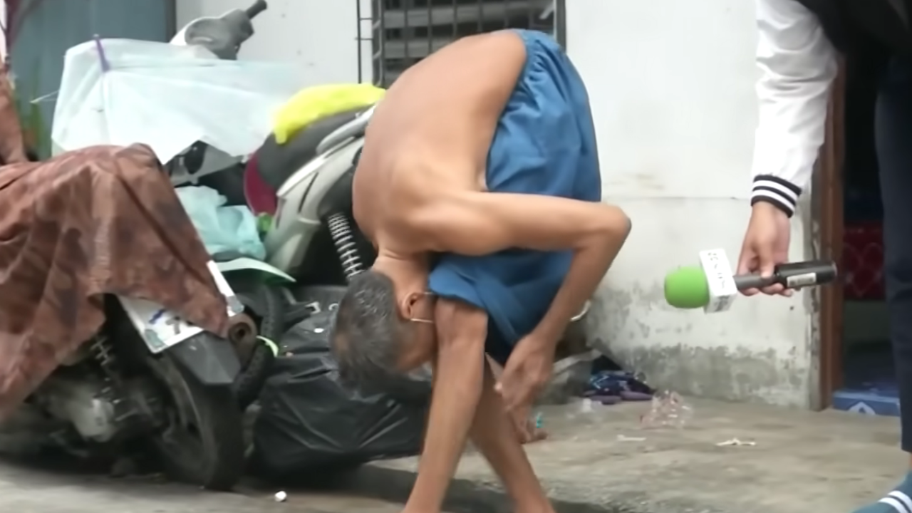 คดีพลิก "ลุงวี" พิการหลังค่อม พบเป็นขอทานข้ามชาติ รายได้หลักแสนต่อเดือน